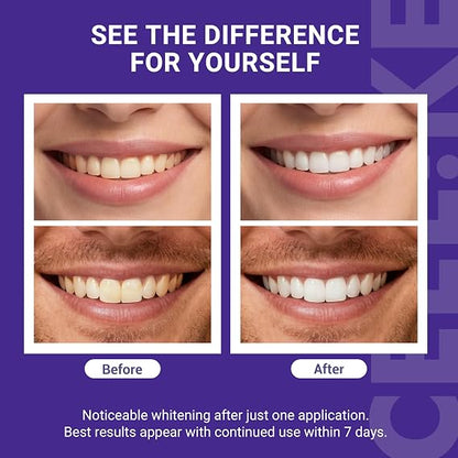 Purple Teeth Whitening Strips – PAP+ & nHAP Dual-Action Tech For Zero-Sensitivity Brighter Smiles